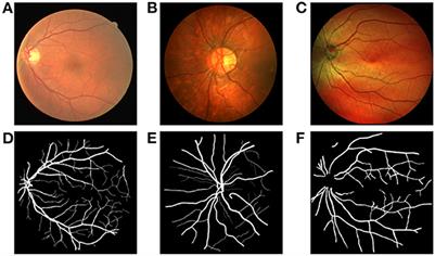 Dual consistent pseudo label generation for multi-source domain adaptation without source data for medical image segmentation